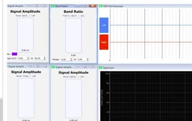 NeuroBT software screenshot